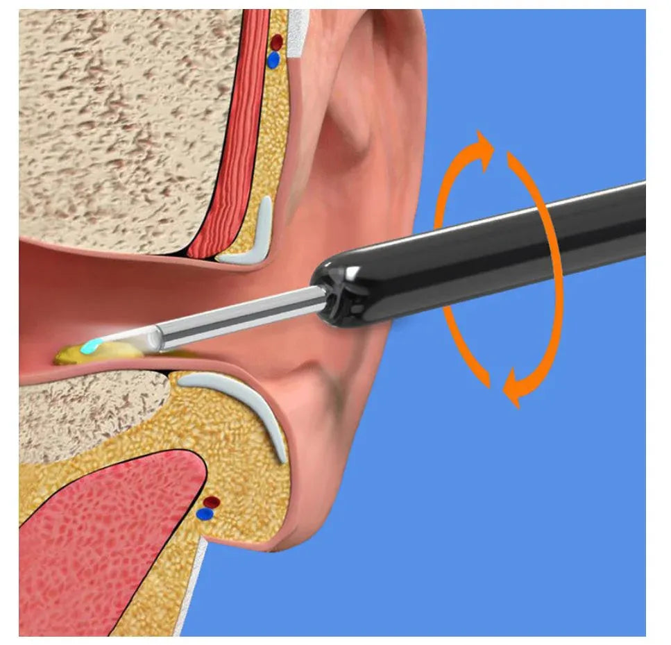 Wireless HD Ear Camera & Earwax Removal Kit | منظف الأذن الذكي بالكاميرا
