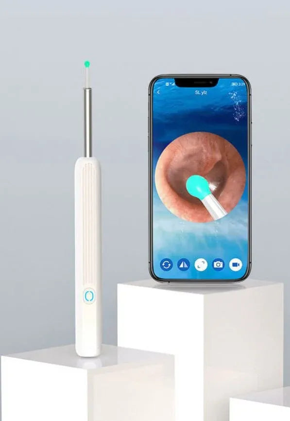 Wireless HD Ear Camera & Earwax Removal Kit | منظف الأذن الذكي بالكاميرا